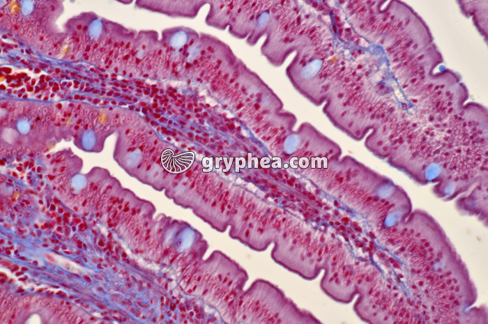 Duodenum x100 - gryphea.org